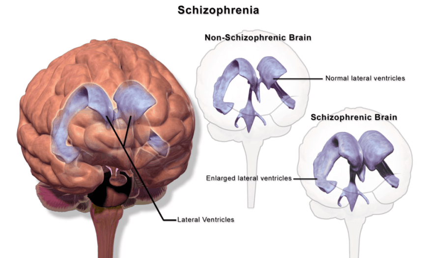 Comment le CBD agit sur le cerveau ?